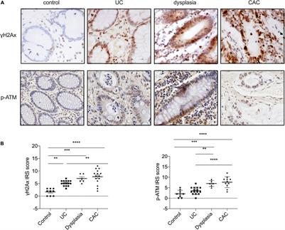 Bifidobacterium infantis Maintains Genome Stability in Ulcerative Colitis via Regulating Anaphase-Promoting Complex Subunit 7